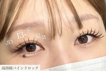 施術事例: 高持続バインドロック